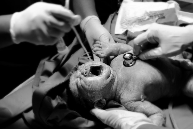 welcome to the world
