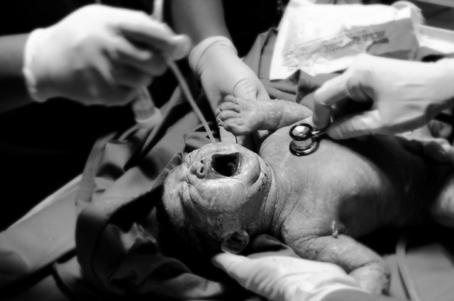 welcome to the world